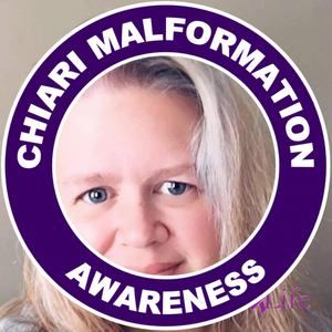 Meet your Posher, Andra